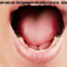 can tonsils grow back after being removed? - tymoff