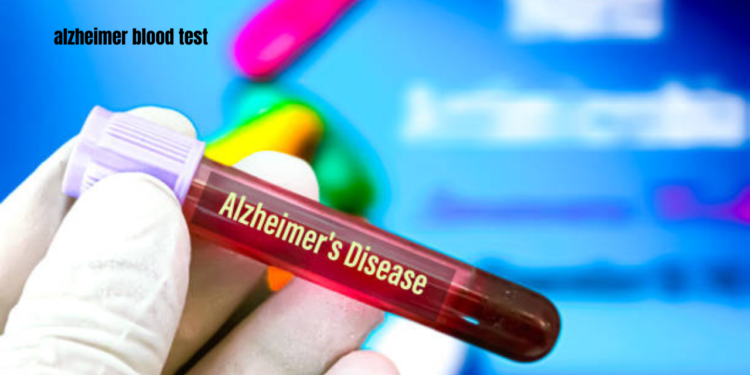 alzheimer blood test